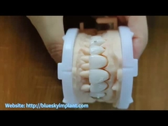 Zirconia crown with  Jewelry