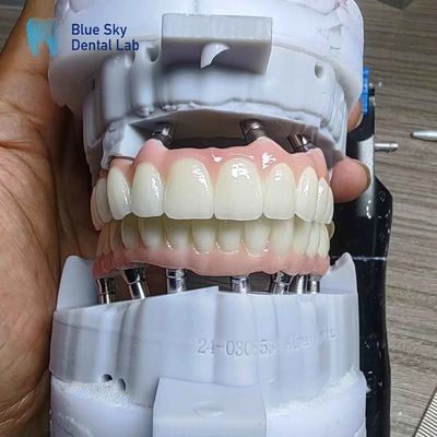 Buy Layered Zirconia Implant Customization Full Arch Implant Cases online manufacture