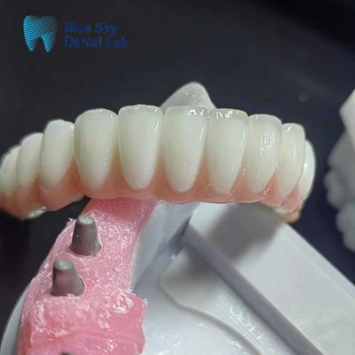 Buy Regular Zirconia Implant Case Personalized Dental Implant Case online manufacture