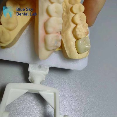 Buy Corrosion Resistant Zirconia Crowns Natural Looking Zirconia Teeth online manufacture
