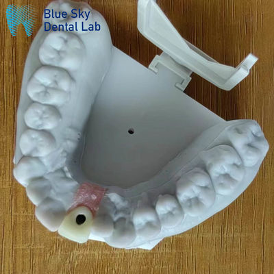 Buy Steam Sterilization Single Implant Crown Smooth Surface Dental Implant Crown online manufacture