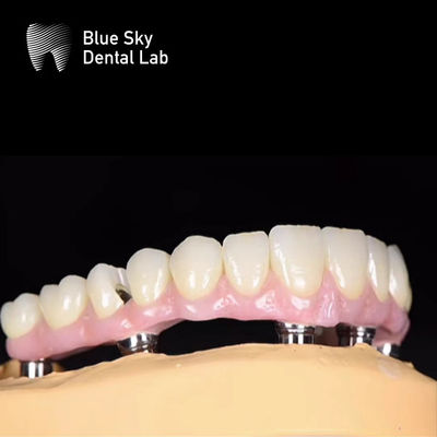 Buy Blue Sky Nature Dental Implant Case Multiple Choices Implant System online manufacture