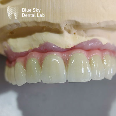 Buy Universal Implant Procedure Cases Full Mouth Implant Case Customized online manufacture