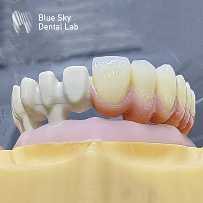 Buy Customize Color Implant Cases with Smooth Surface Nature Design for Universal Compatibility online manufacture
