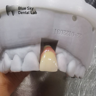 Buy Regular Implant Cases Universal Compatibility Dental Implant Case online manufacture