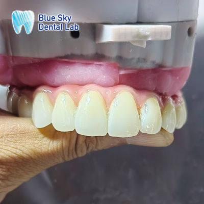 Buy Implantation Cases for Multiple Implant Systems online manufacture