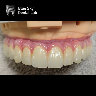 Buy Universal Multiple Choices Implant Cases Designed For Smooth Surface And Sterile Steam Cleaning online manufacture