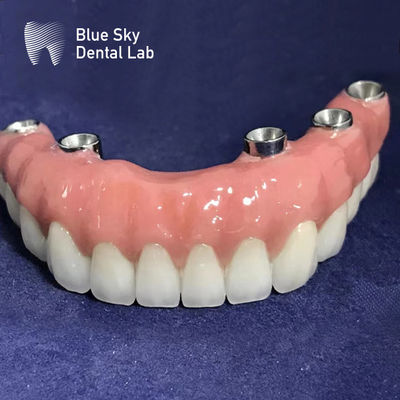 Buy Universal Autoclavable Rectangular Implant Cases Smooth Surface Silver Color online manufacture