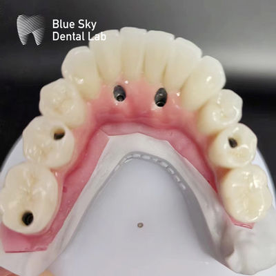 Buy Full Arch Dental Implant Cases Compatible With Multiple Implant Systems online manufacture