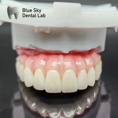 Buy Nature Dental Implant Cases Smooth Full Mouth Implant Case For Implant System online manufacture
