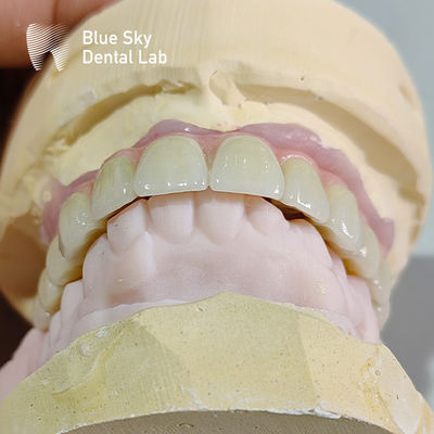 Buy Implant Operation Cases / Implant Procedure Cases for Diverse Implant Choices and Sterilizations online manufacture