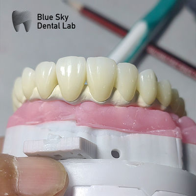 Buy Universal Dental Implant Case Compatible With Multiple Implant Systems online manufacture