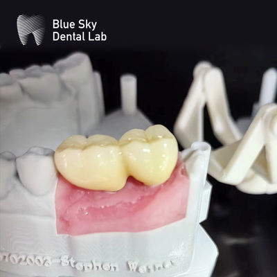 Buy Smooth Surface Implant Cases Steam Sterilization Dental Implant Cases online manufacture