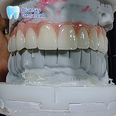 Buy Artificial Dental Implant Case Multiple Sterilization Implant Cases online manufacture
