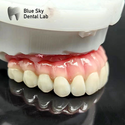 Buy Customized Full Mouth Implant Case Universal Compatibility online manufacture