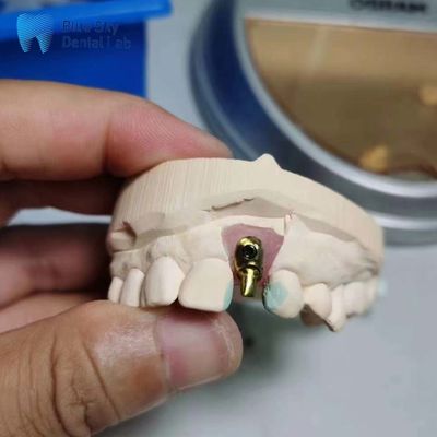 Buy Regular Implant Cases Customizable Single Implant Tooth  Offset Arch Implant Case online manufacture