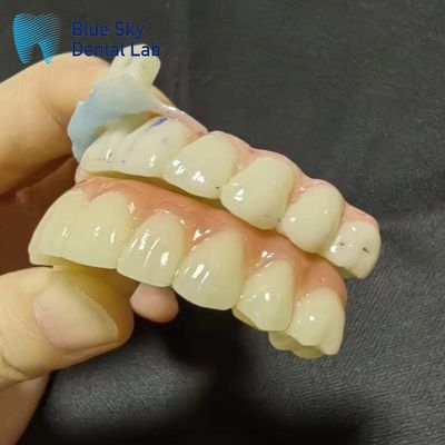 Buy Implantation Cases Artificial Implantation Cases for Seamless System Compatibility online manufacture