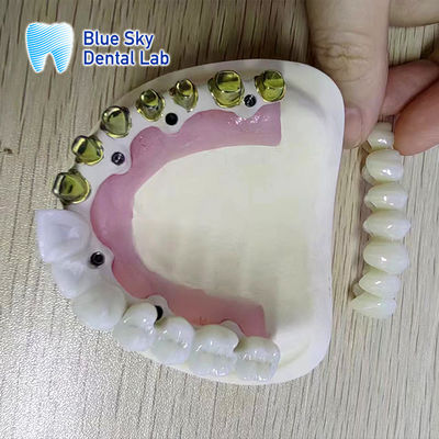 Buy Universal Full Arch Dental Implant Cases For Multiple Regular Implant System online manufacture