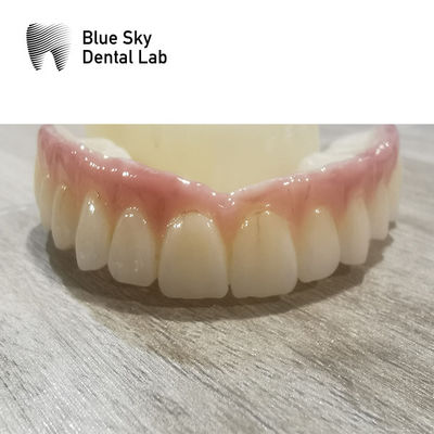 Buy Compatibility Implant Cases Regular Implant System Dental Cases online manufacture