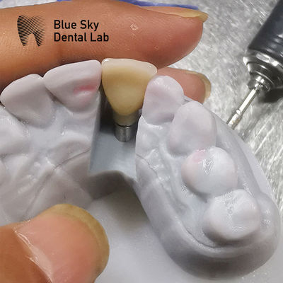 Buy Biocompatibility Studies Implantation Scenarios Steam Sterilization online manufacture