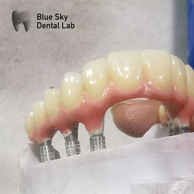 Buy Nature Shape Full Arch Implant Cases Smooth Surface Dental Implant Case online manufacture