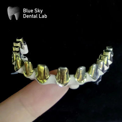 Buy Silver Gold Universal Pure Titanium Metal Frame Dental Customizable online manufacture