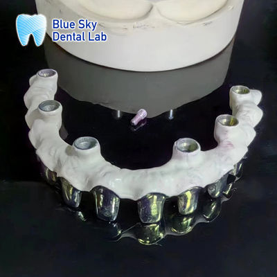 Buy Pure Titanium Malo Bridge Customizable Silver Metal Frame Teeth online manufacture