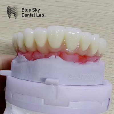 Buy Nature Implant Procedure Cases with Universal Compatibility and Optimal Performance online manufacture