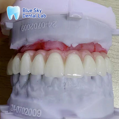 Buy Customize Color Smooth Surface Implantation Instrument Cases online manufacture