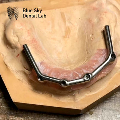 Buy Full Upper Dental Titanium Bar Full Mouth Restoration Blue Sky Implant online manufacture