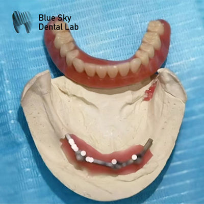 Buy Blue Sky Implant Titanium Bar Dental For Implant Dentures online manufacture