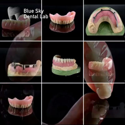 Buy Universal Customized Dental Titanium Bar  With Acrylic Denture online manufacture