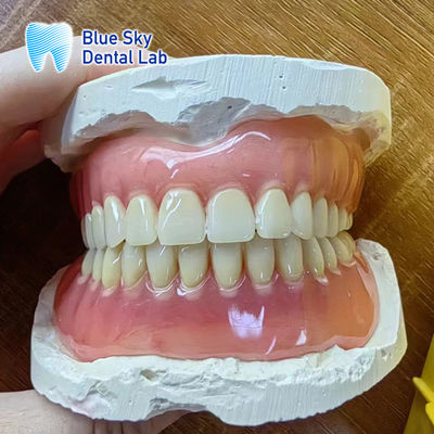 Buy Missing Teeth Acrylic full Denture Restoration Acrylic Complete Denture online manufacture
