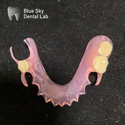 Buy Customize Removable Acrylic Partial Denture Natural Looking Valplast Dental Partials online manufacture
