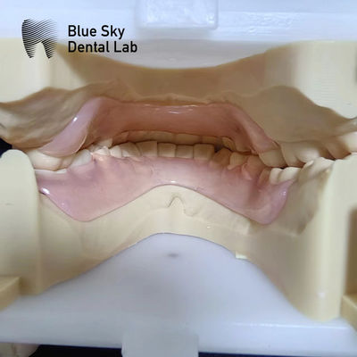 Buy Resin Valplast Flexible Partial Dentures Before And After Valplast Partial Denture online manufacture