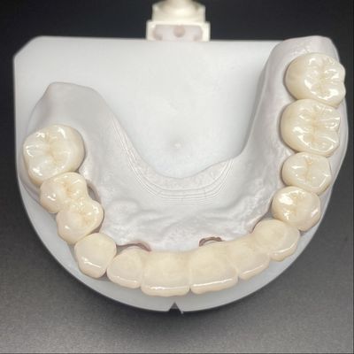 Buy Layered Zirconia Bridge For Fixed Restoration Beautiful Smiles Professional Stable online manufacture