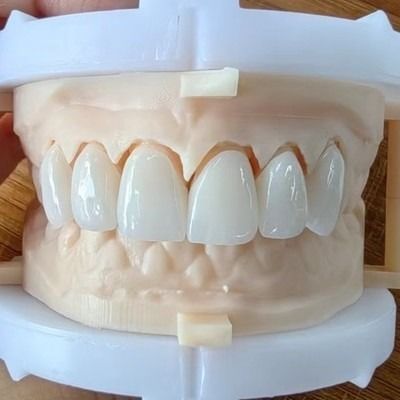 Buy Natural Esthetics Layered Zirconia Crown Bridge For Beautiful Smile And Good Restoration FDA And CE Certification online manufacture