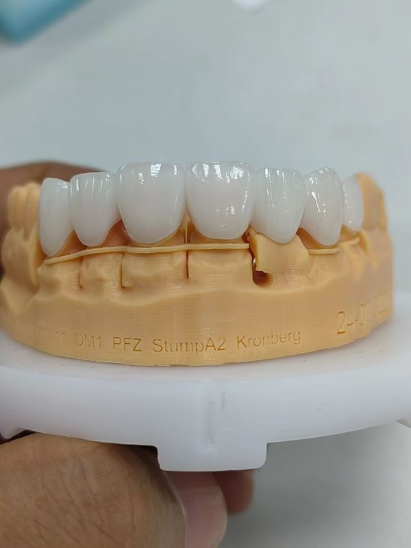 5mm 6mm Layered Zirconia Crowns Strength Zirconia Multilayer Crown