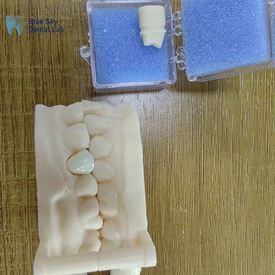 Aesthetic Zirconia Dental Restorations Zirconia Porcelain Crowns