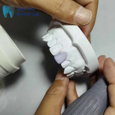 0.3mm Thin Glass Ceramic Veneer Implants Lightweight Veneer Cases