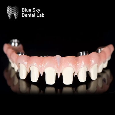 Customizable Pure Titanium Malo Bridge Dental Blue Sky Implant System