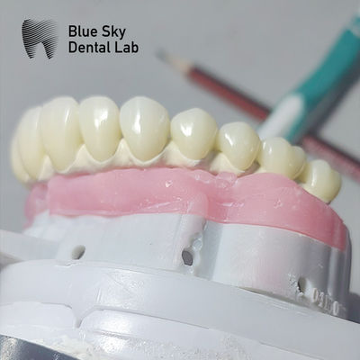 Pure Titanium Malo Implant Bridge Universal Metal Frame Malo Bridge