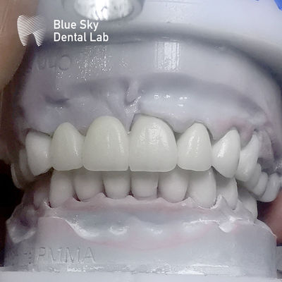 Rectangular Layered Zirconia Teeth Multilayer Before Glazing
