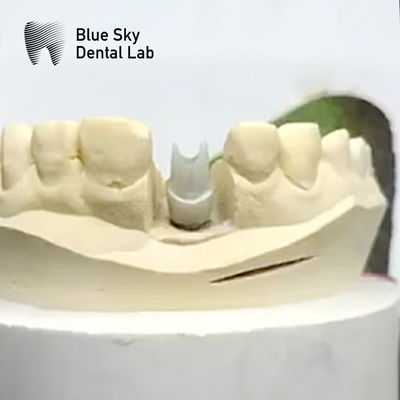 Aesthetic Zirconia Abutment Implant Biocompatible Precision Milled