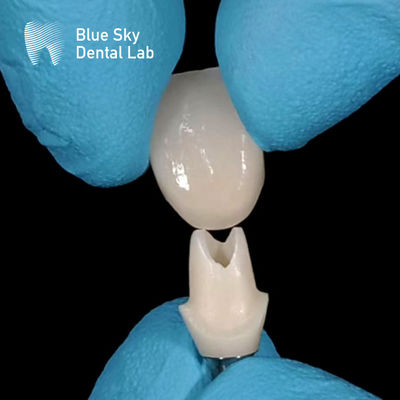 Oral Scan Custom Zirconia Abutment High Strength Zirconia Abutments