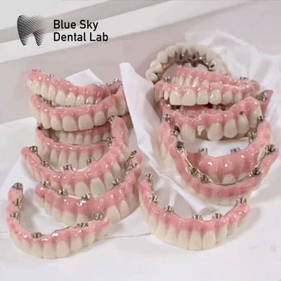 Blue Sky Implant Cases With Malo Frame Bridge Pure Titanium