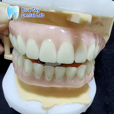 Bluesky Temporary Acrylic Partial Denture Full Upper And Lower Acrylic Denture