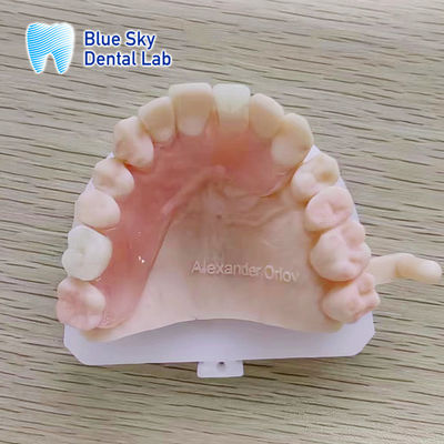 Natural Looking Removable Valplast Partial Dentures For Upper Anterior And Posterior Teeth