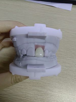 High Durability Implant Cases Holds Up To 5 Implants for Removable Prosthesis Flexibility